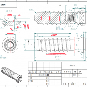 西鈦珂醫療骨科加工案例： 牙齒種植體